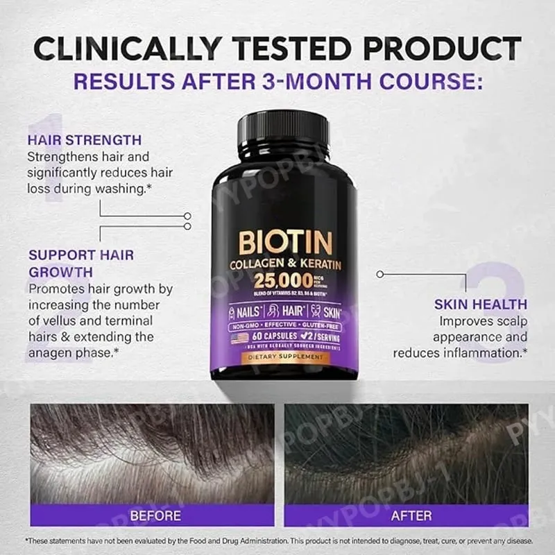 Biotin Capsules Contain Collagen and Vitamin B2 B3 B6 & B7 for Women Men Hair Care Supplements Skin & Nails Support 60 Pieces