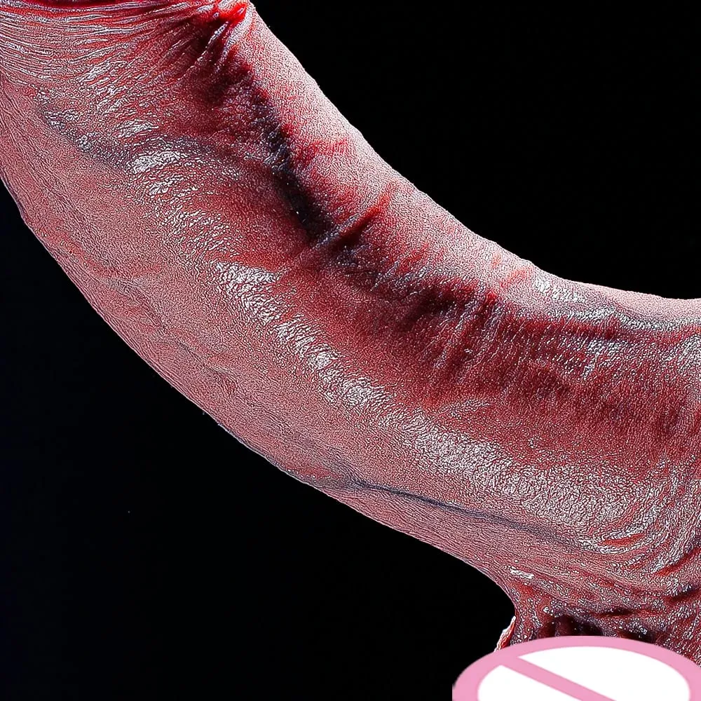 Huge Thick Dildo Realistic Dildos Diameter Girth Dildo for Anal G-spot Stimulate Body-Safe Big Anal Toys with Suction Cup Giant — image 1