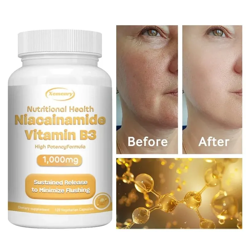 Niacinamide Vitamin B3 Capsules - Supports Brain Function and Heart Health Boosts Energy Production and Enhances Immunity — image 1